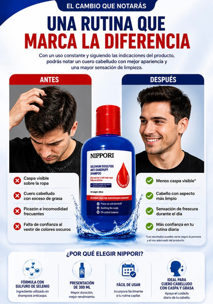 Shampoo Anticaspa Nippori